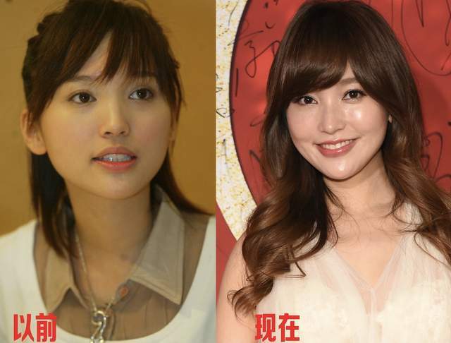 自然之美的女明星，不整容的真实价值